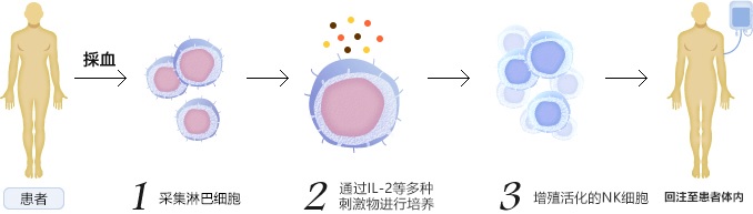 细胞免疫治疗流程