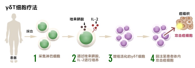 γδT细胞疗法