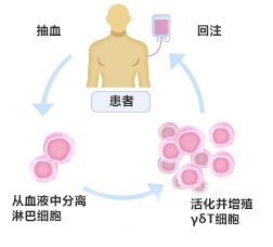 日本γδT细胞疗法