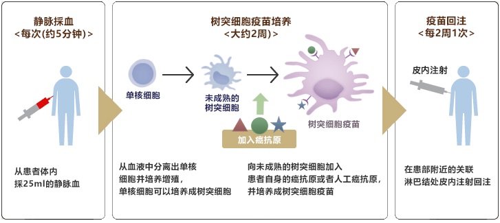 树突细胞疫苗疗法的流程