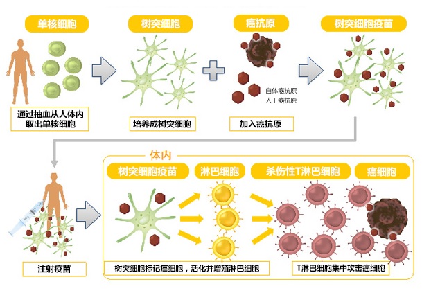 树突细胞疫苗治疗流程