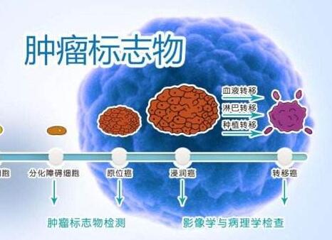 肺癌常见的肿瘤标志物你知道吗