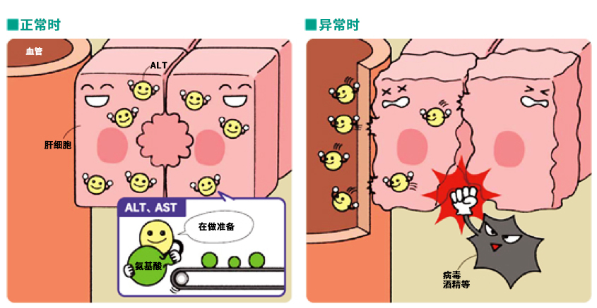 肝炎 劇 症