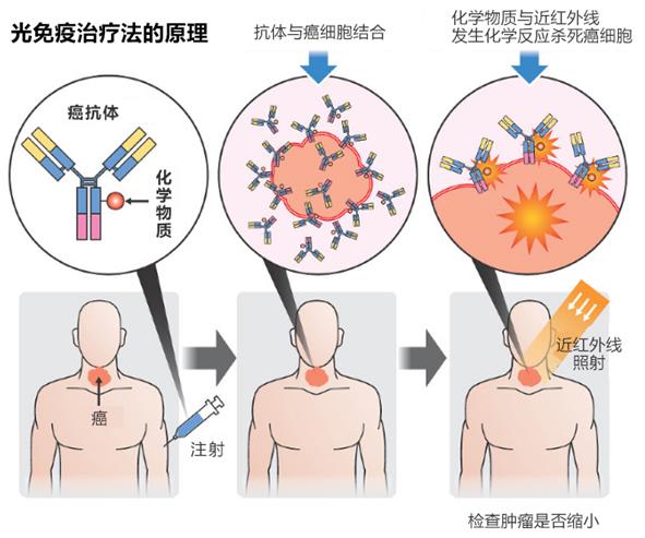 光 免疫 療法 2020