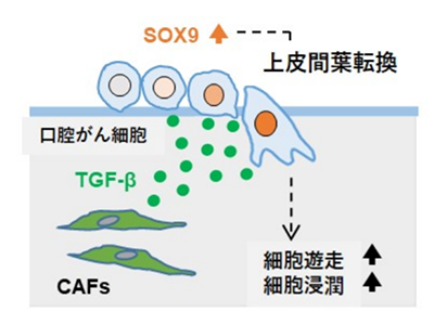 CAF分泌的TGF-β与口腔癌的恶性程度密切相关 - 新潟大学