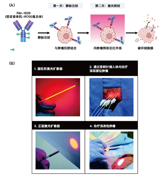 日本：“光免疫疗法”最新动态