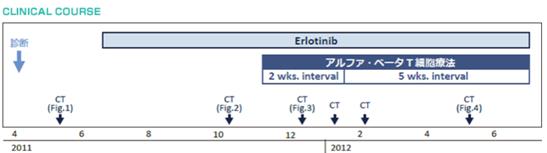 EGFR阳性晚期肺癌选择免疫细胞疗法自救