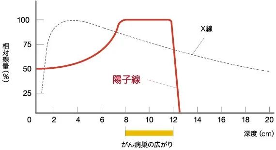 日本治疗儿童肿瘤的优势：质子治疗