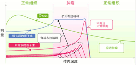 质子重离子治疗优势2