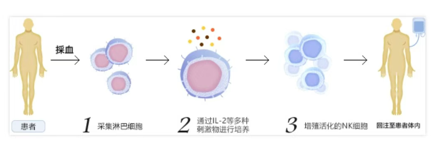 抗癌“细胞士兵”有哪些？免疫细胞疗法分类详解